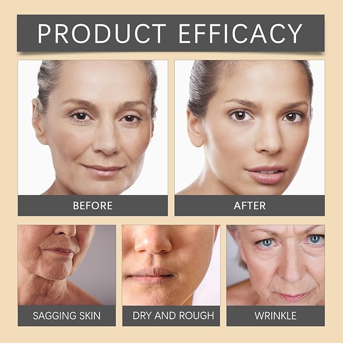 Crema Facial para Arrugas BeeLift™ | Revela Hoy Tu Piel de Mañana