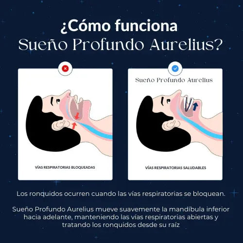 Nocsleep® | Dispositivo para un Descanso Perfecto