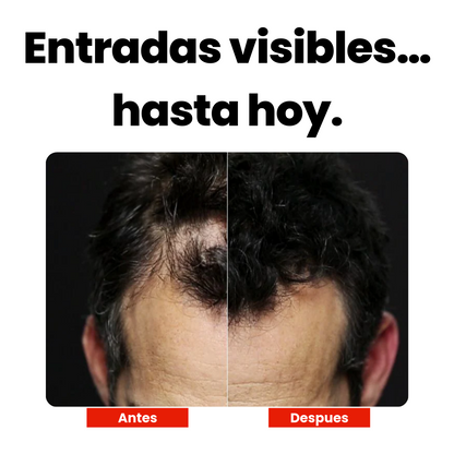 Toppik™ - Fibra capilar para el cabello