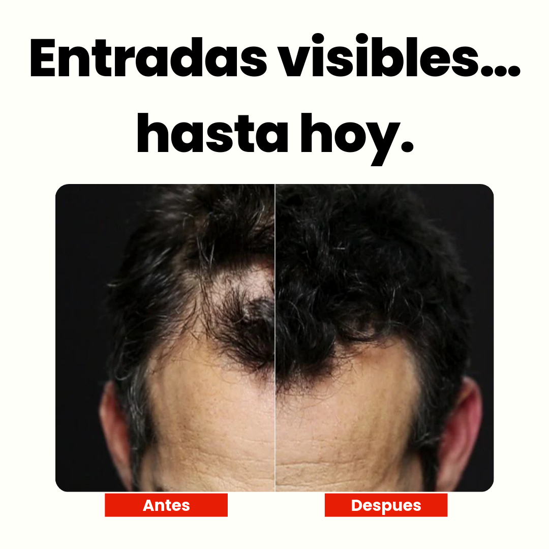 Toppik® Fibra capilar para el cabello